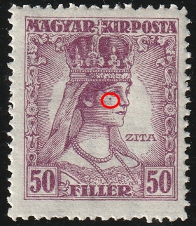 Anyajegy Zita királyné arcán